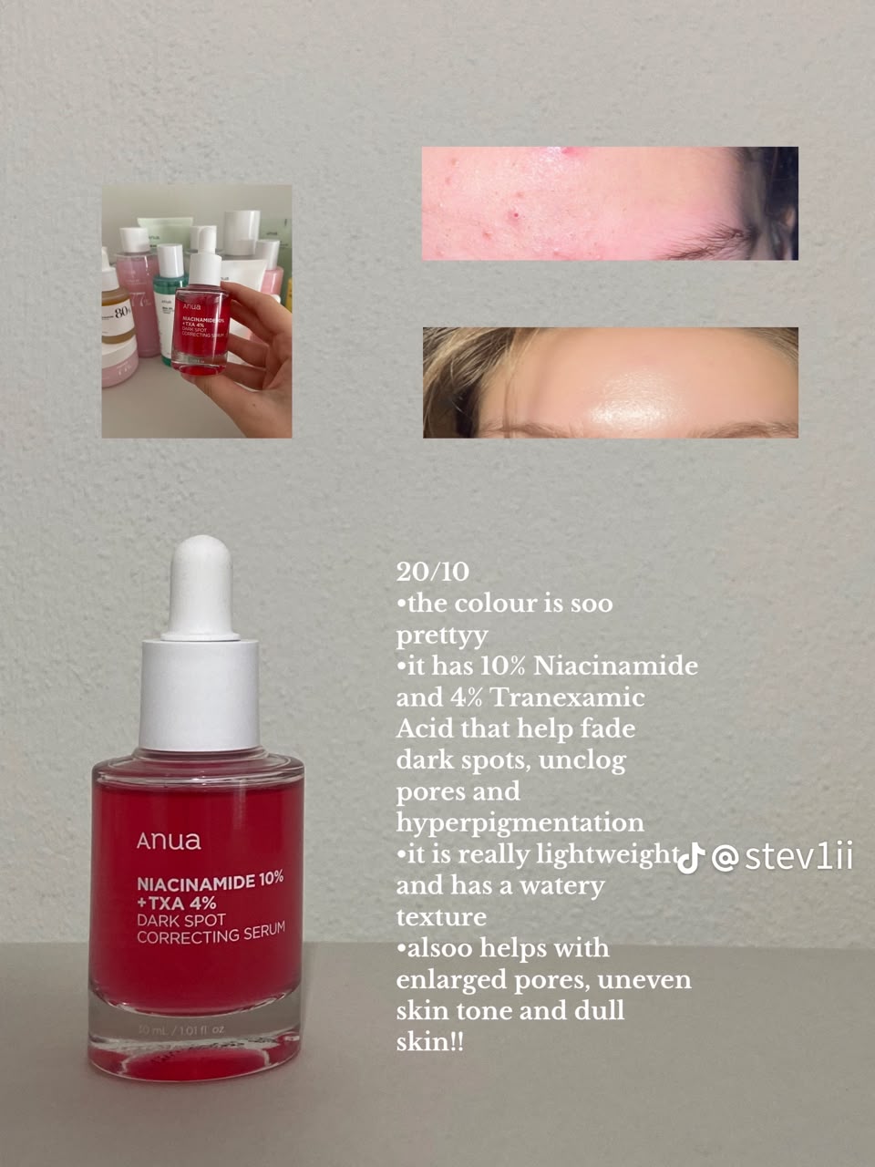 ✨ ANUA Niacinamide 10% Serum – Your Secret to Clear, Radiant Glass Skin! ✨