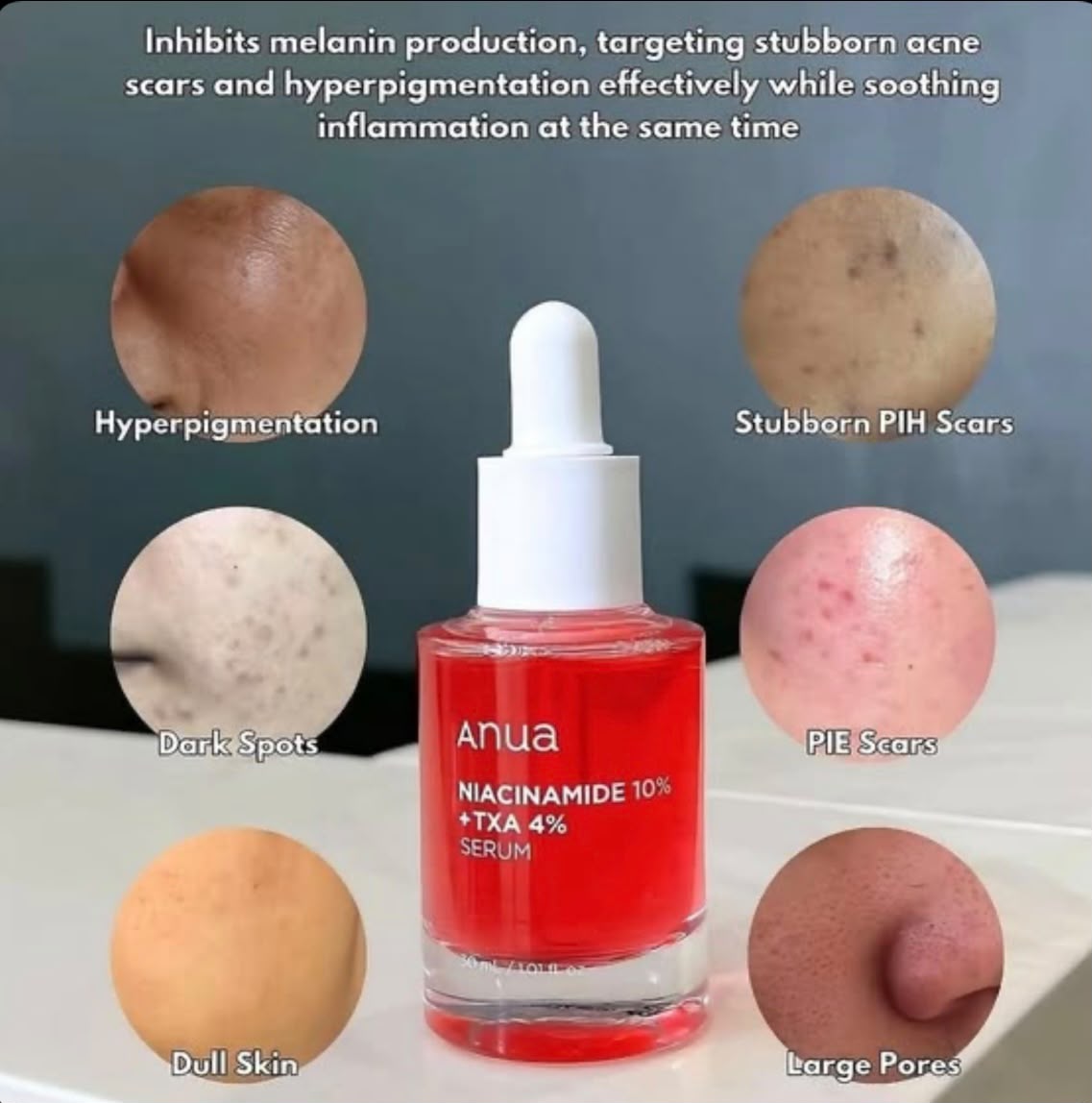 ✨ ANUA Niacinamide 10% Serum – Your Secret to Clear, Radiant Glass Skin! ✨