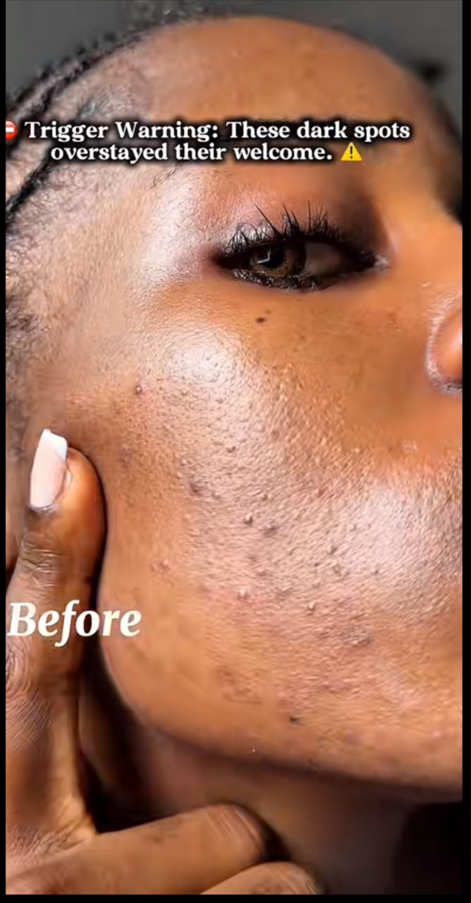 Dark Spot Correcting Glow Serum
